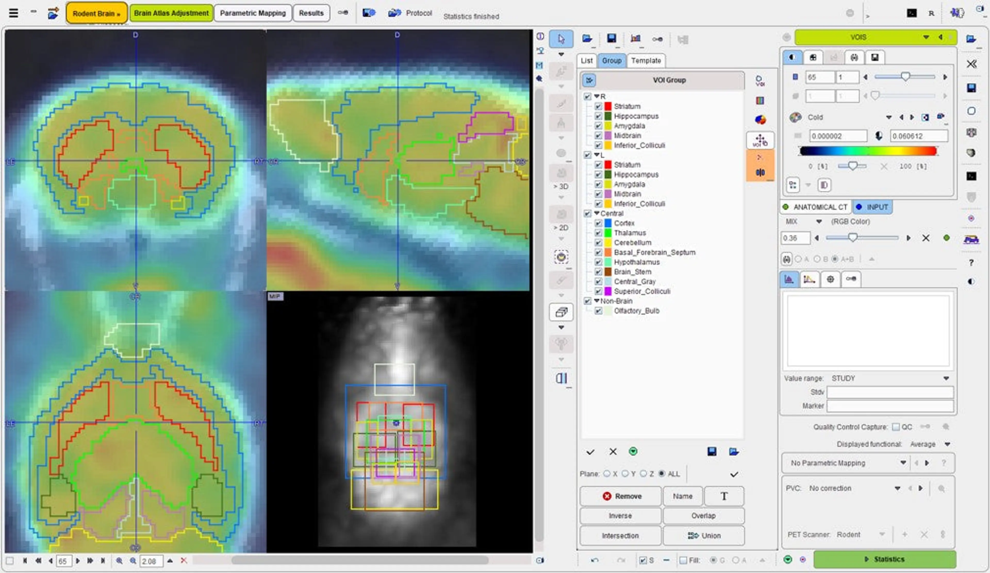 PNROD Rodent Brain Analysis (Remote)