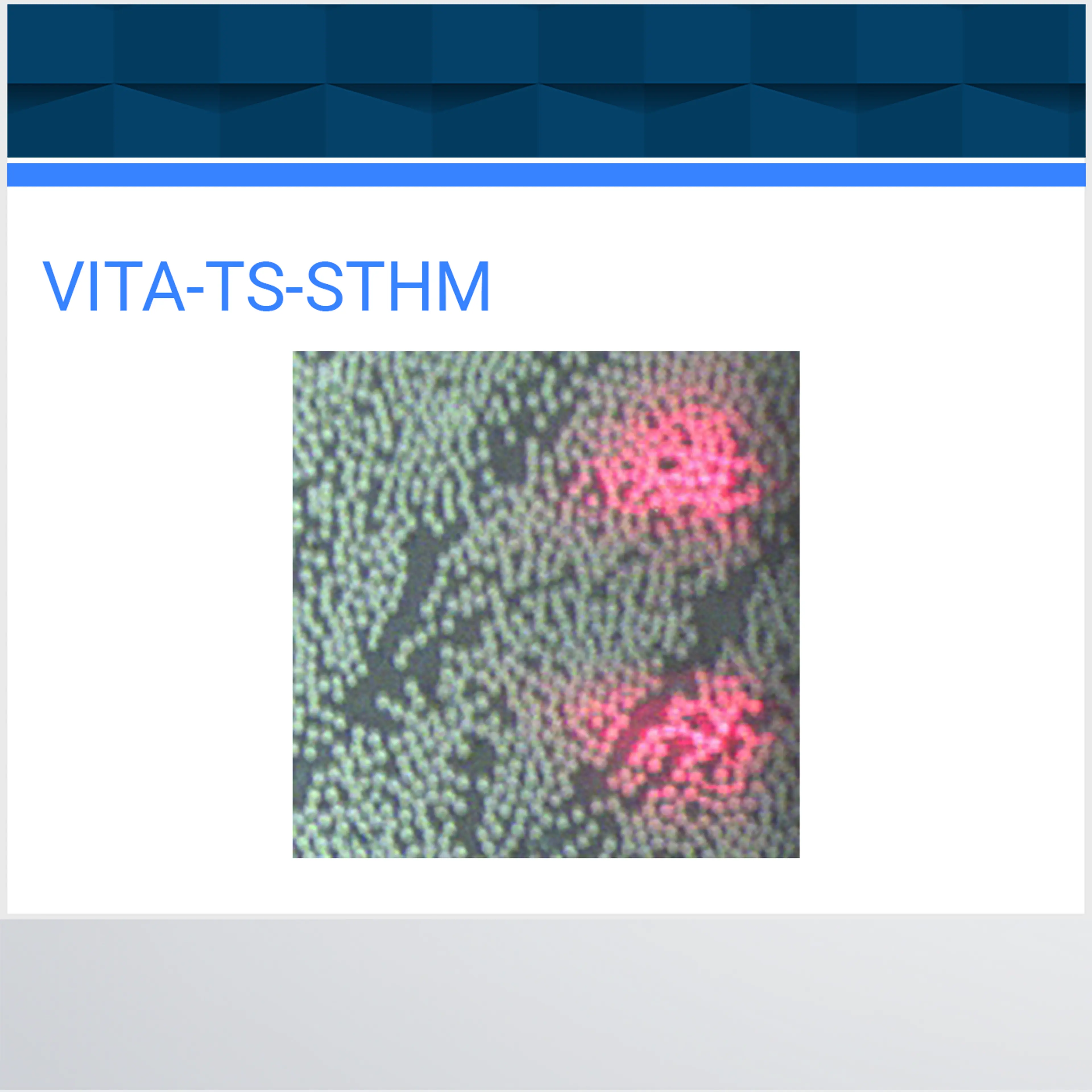 VITA-TS-STHM