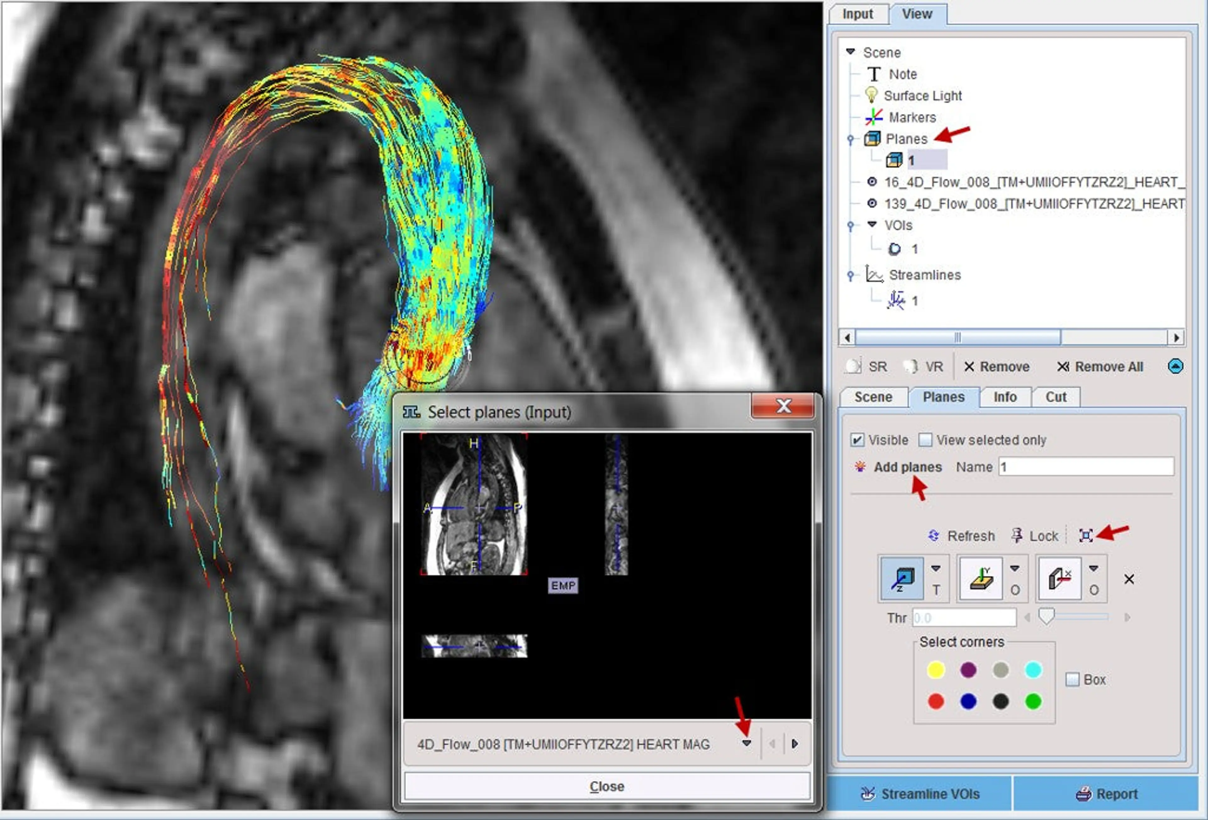 PGEM CFD 4D-Flow DTI (Remote)