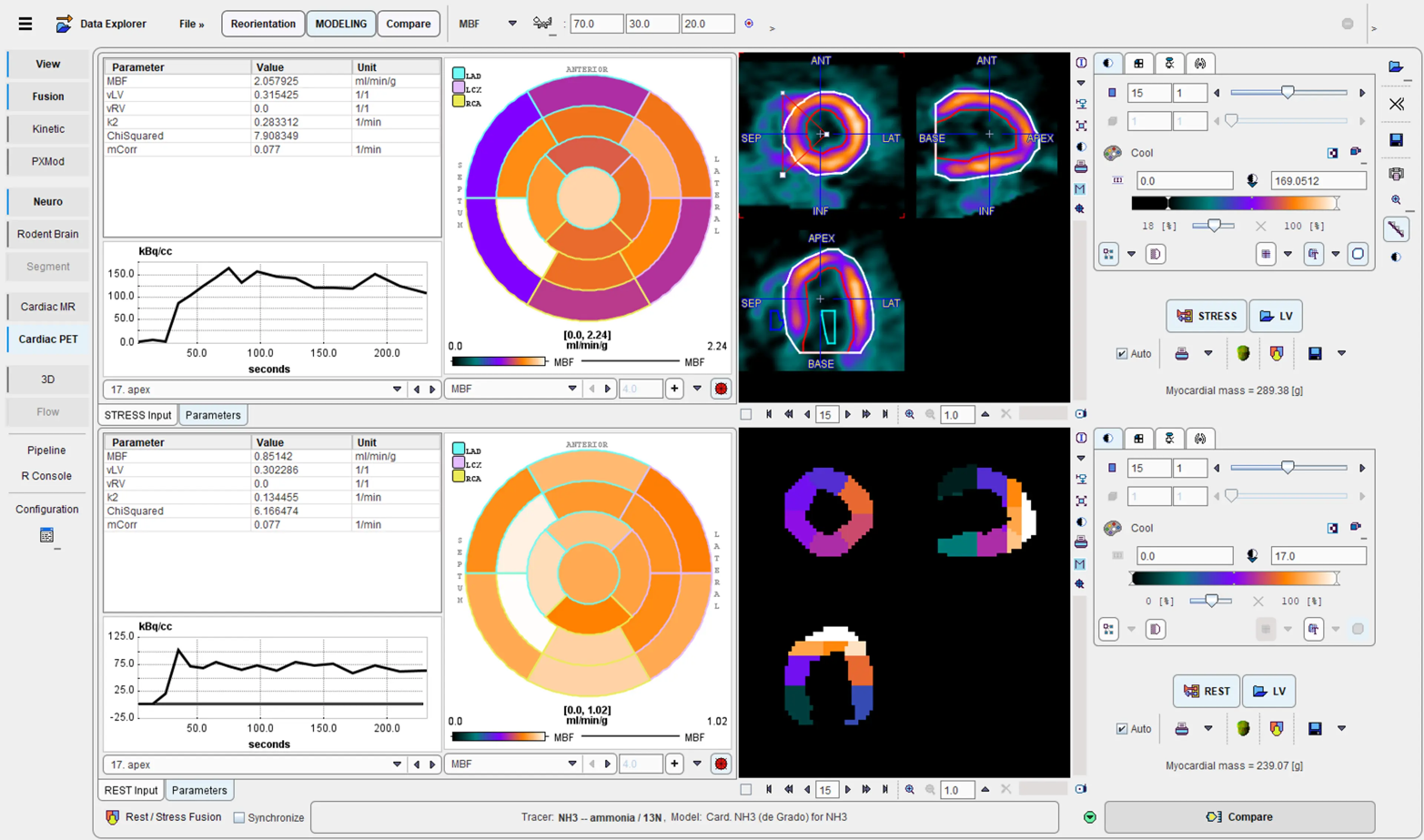 PCARDP Cardiac PET Analysis (Remote)
