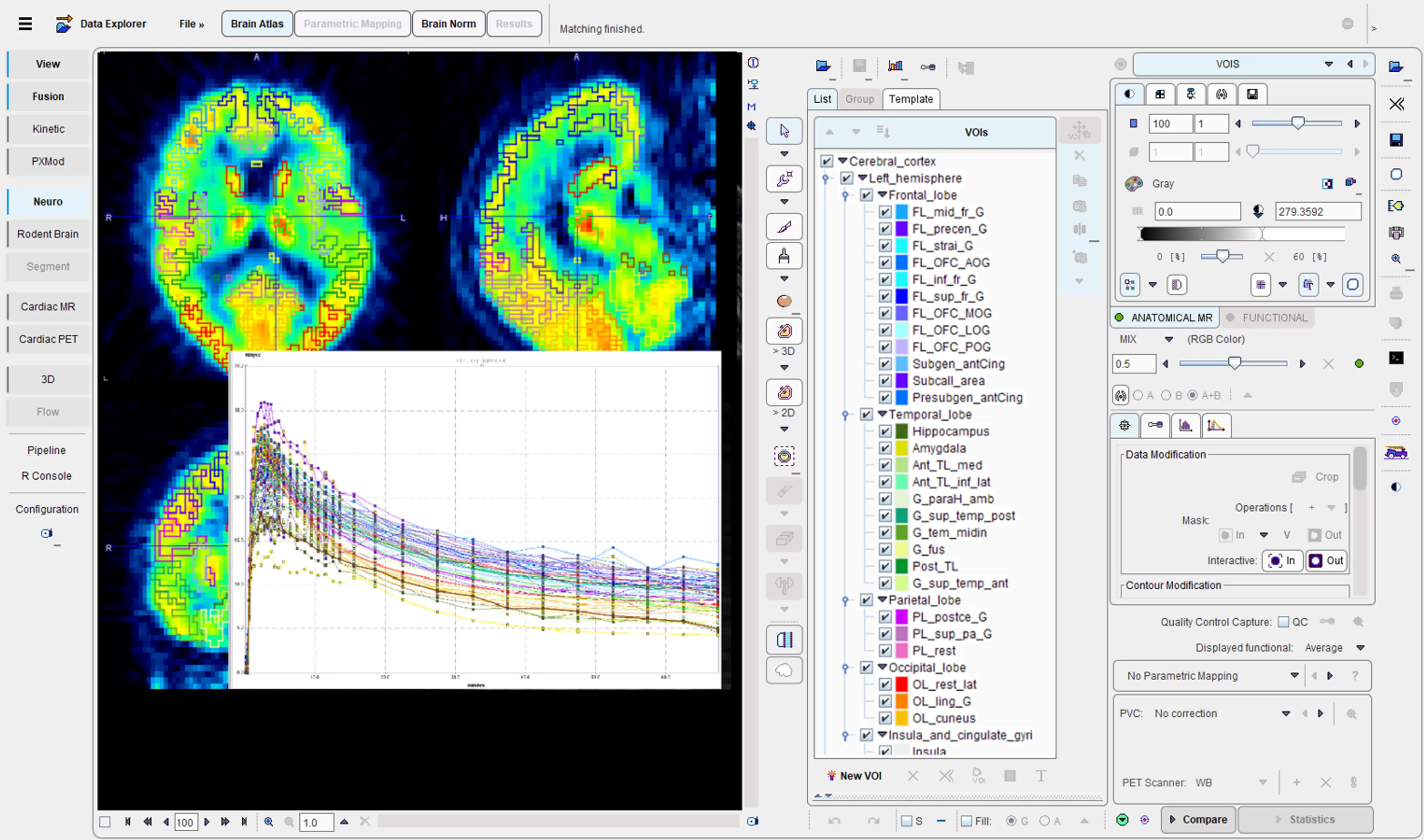 PNEURO Human Brain Analysis (Remote)