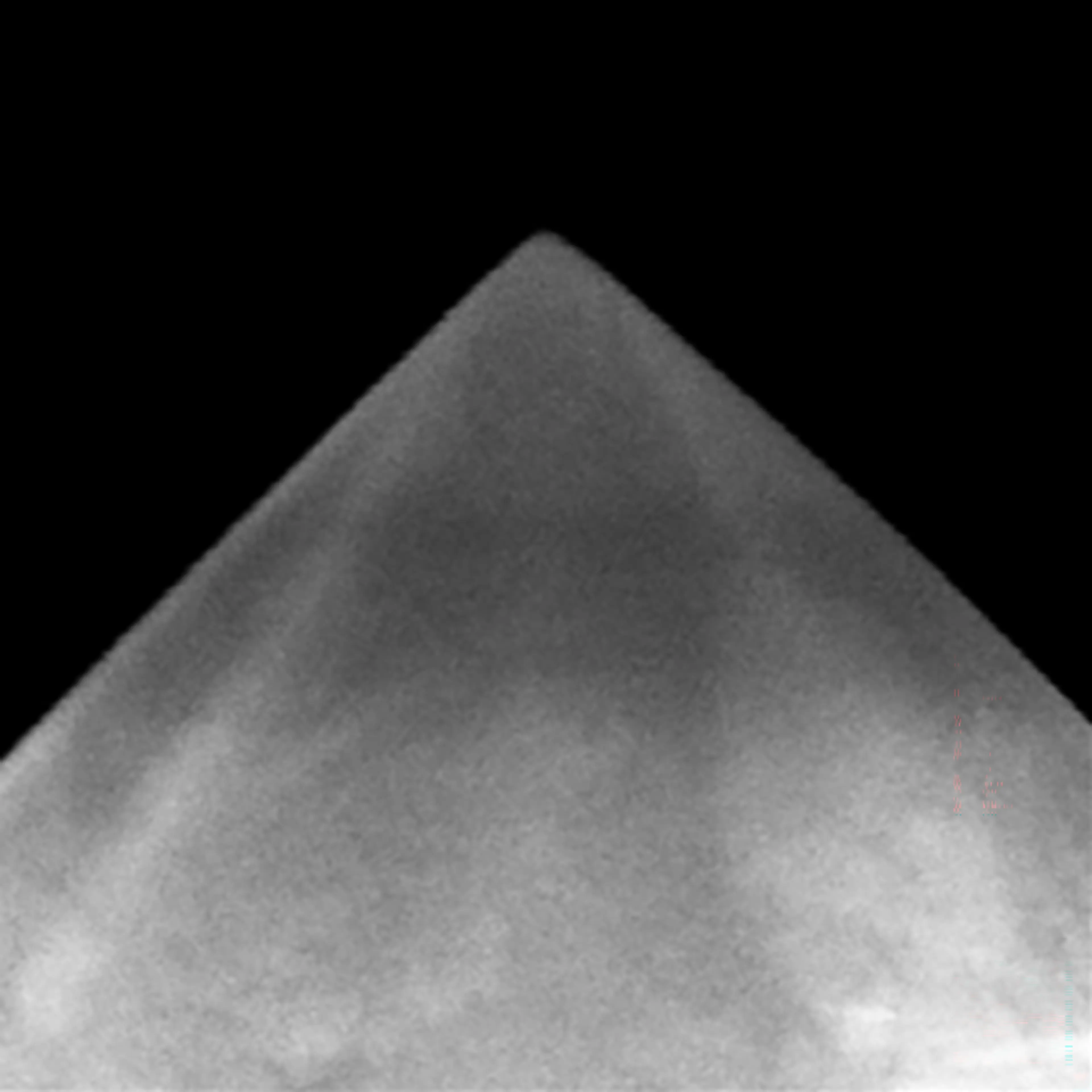 NM-RC-SEM